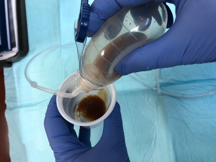 Surgical Drain Care Maher A. Abbas, MD Proctology, Colonoscopy