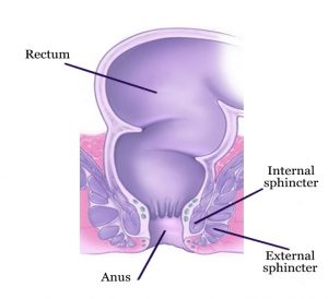 Treatment Anal Warts